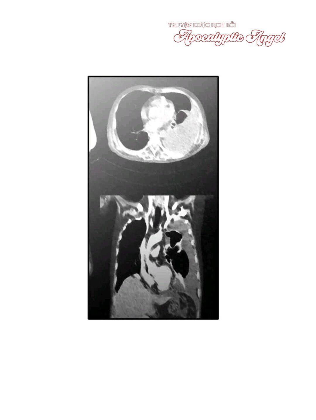 đọc truyện Chúng Ta Đều Là Kẻ Ngốc Chương 16 ảnh 8 tại Thiên Thai Truyện