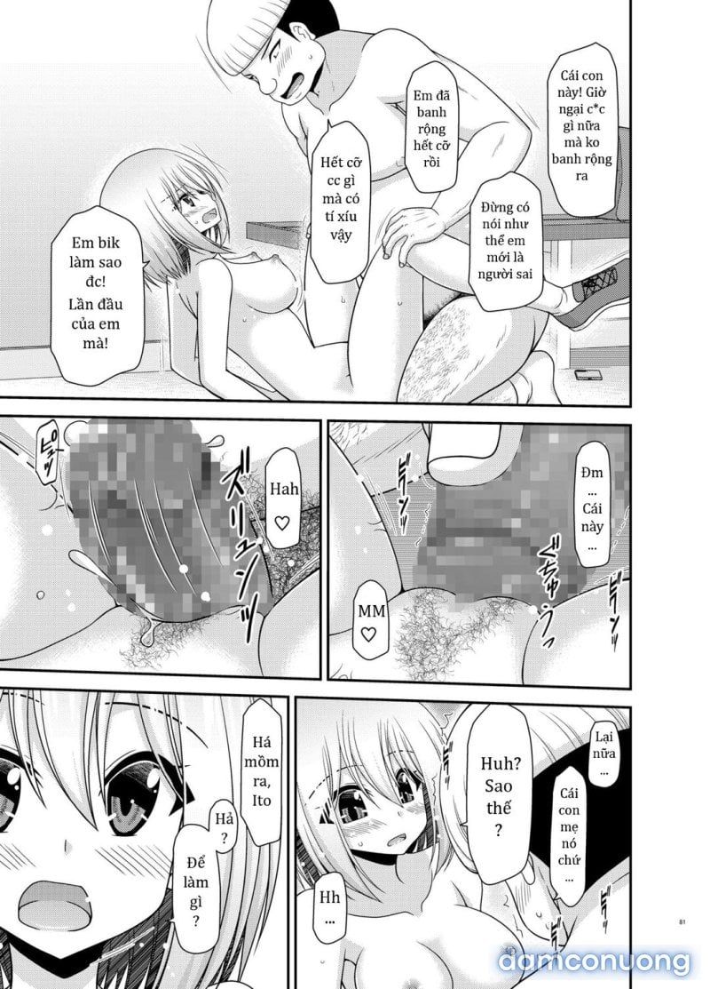 đọc truyện Nozokare Roshutsu Shoujo Chương 2 ảnh 82 tại Thiên Thai Truyện