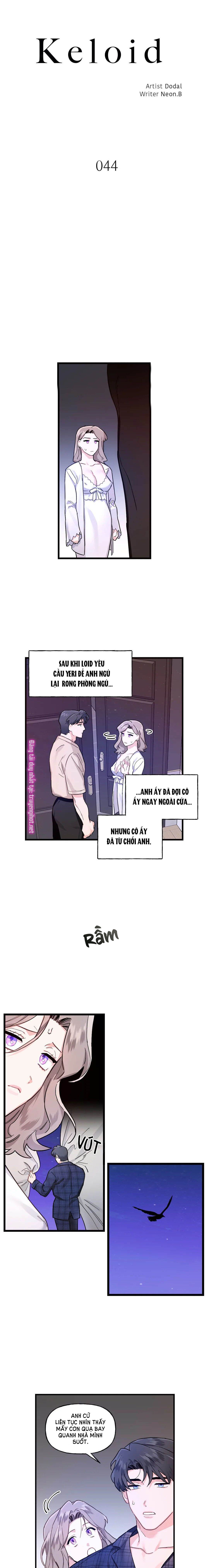 đọc truyện Sẹo Lồi Chương 44.1 ảnh 3 tại Thiên Thai Truyện