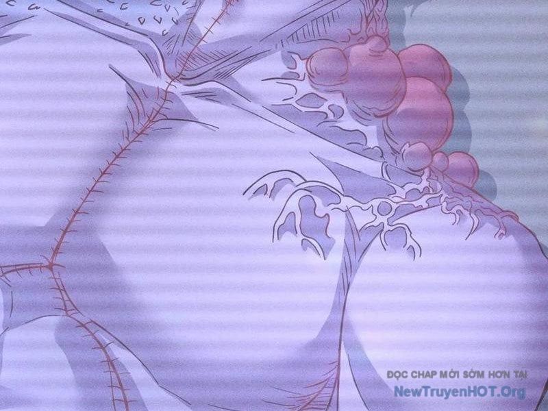 đọc truyện Ta Vô Địch Phản Sáo Lộ Chương 67 ảnh 11 tại Thiên Thai Truyện